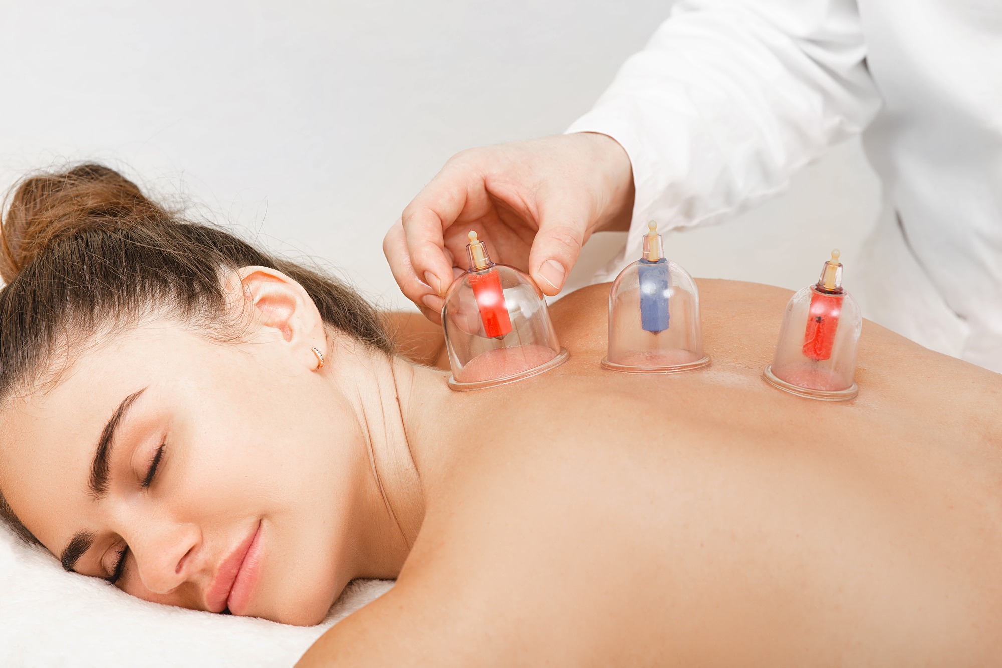 Traditional Chinese medicine doctor doing massage with vacuum cups to a female patient.